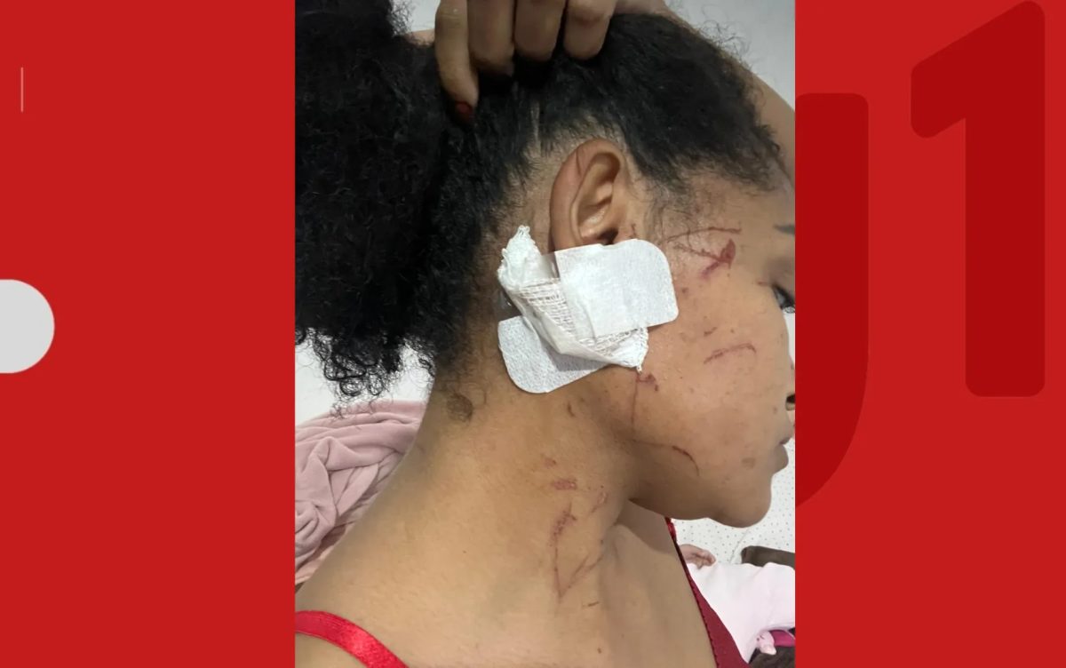 Mulher relata ter sido arrastada por carro de ex-companheiro após briga em Feira de Santana